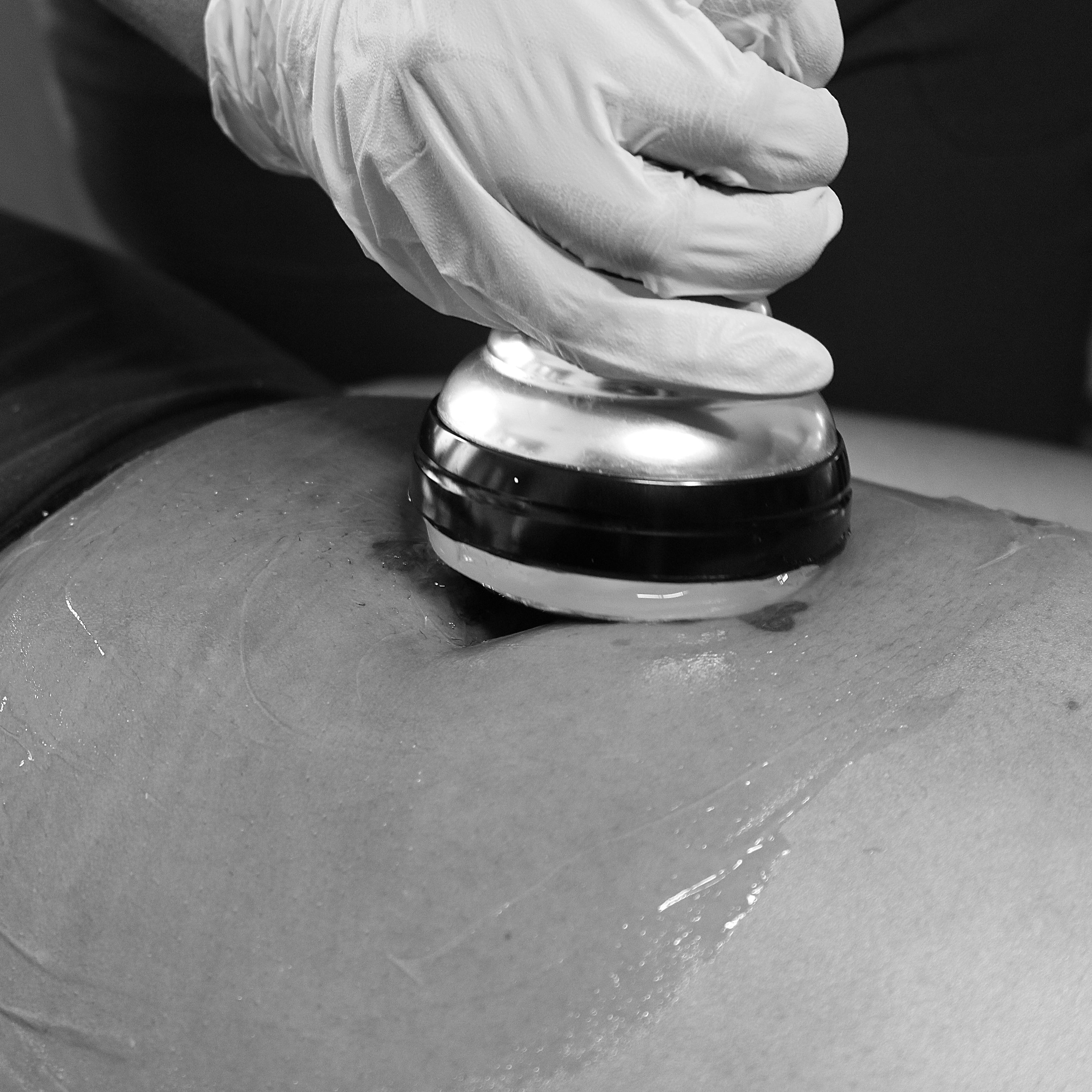 Vacuum Therapy